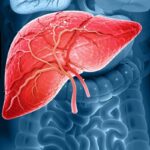 Gordura no fígado aumenta risco cardiovascular e exige mudança de hábitos, explica hepatologista
