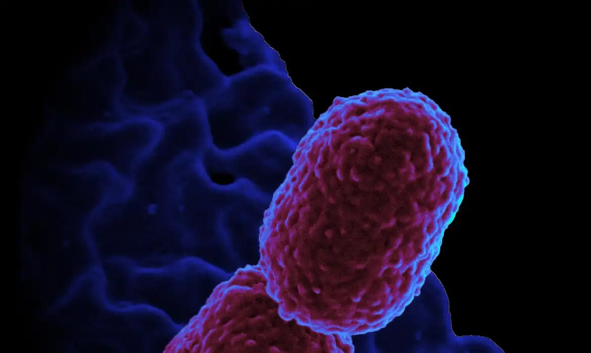 klebsiella pneumoniae bacterium
