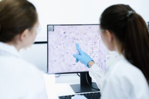 Anvisa registra nova opção para pacientes com linfoma agressivo