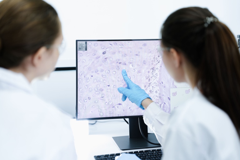 Anvisa registra nova opção para pacientes com linfoma agressivo 1 Anvisa registra nova opção para pacientes com linfoma agressivo